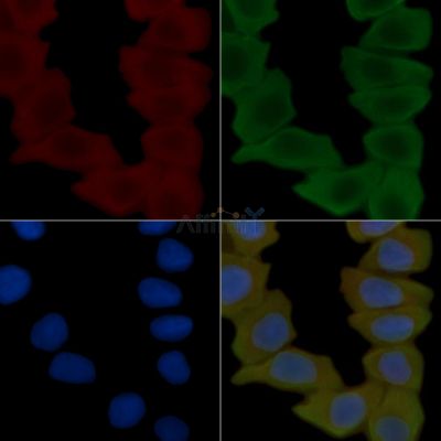 mGluR4 Antibody - AF5459 staining Hela cells(30min of UV treatment) by IF/ICC.