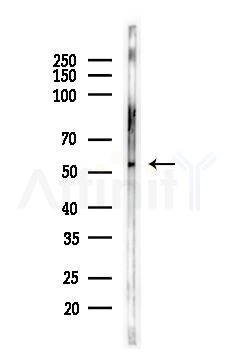 GLUT1 Antibody - Western blot analysis of lysates from HepG2 cells(starvation,24h treatment), using GLUT1 Antibody at 1/1000 dilution.
