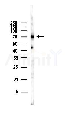 HSP70 Antibody - Western blot analysis of lysates from EC304 cells(LPS,4h treatment), using HSP70 Antibody at 1/1000 dilution.