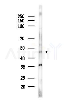 NSE Antibody - Western blot analysis of lysates from HepG2 cells(starvation,24h treatment), using NSE Antibody at 1/1000 dilution.