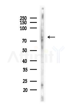 FSHR Antibody - Western blot analysis of lysates from HepG2 cells(starvation,24h treatment), using FSHR Antibody at 1/1000 dilution.