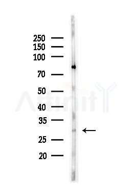 VDAC1 Antibody - Western blot analysis of lysates from Mouse lung, using VDAC1 Antibody at 1/1000 dilution.