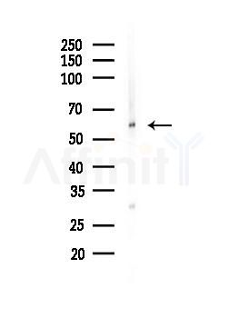 Cytokeratin 5 Antibody - Western blot analysis of lysates from Mouse lung, using Cytokeratin 5 Antibody at 1/1000 dilution.