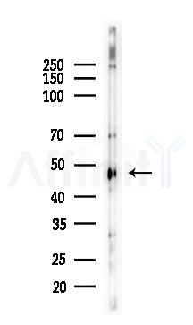 Cytokeratin 17 Antibody - Western blot analysis of lysates from HepG2 cells(starvation,24h treatment), using Cytokeratin 17 Antibody at 1/1000 dilution.