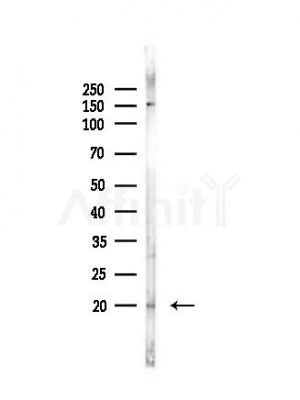 p14 ARF Antibody - Western blot analysis of lysates from Hela cells(UV, 30min treatment), using p14 ARF Antibody at 1/1000 dilution.