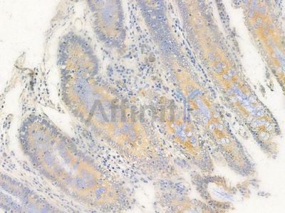 p15 INK4b Antibody - AF5486 at 1/100 staining human normal colon tissue by IHC-P.