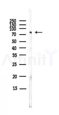 p63 Antibody - Western blot analysis of lysates from EC304 cells(LPS,4h treatment), using p63 Antibody at 1/1000 dilution.