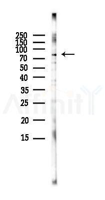 p63 Antibody - Western blot analysis of lysates from HUVEC cells(LPS,4h treatment), using p63 Antibody at 1/1000 dilution.