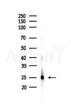 PGP9.5 Antibody - Western blot analysis of lysates from Mouse lung, using PGP9.