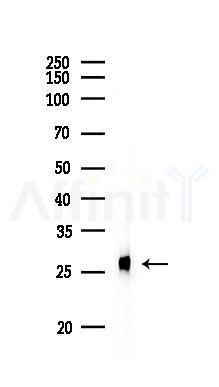 PGP9.5 Antibody - Western blot analysis of lysates from PC12 cells, using PGP9.