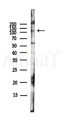 EPHA4 Antibody - Western blot analysis of lysates from EC304 cells(LPS,4h treatment), using EPHA4 Antibody at 1/1000 dilution.