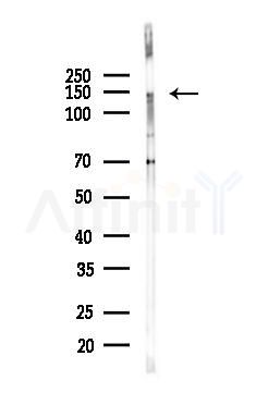 TRIM66 Antibody - Western blot analysis of lysates from HepG2 cells(starvation,24h treatment), using TRIM66 Antibody at 1/1000 dilution.