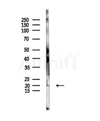 HSP20 Antibody - Western blot analysis of lysates from PC12 cells, using HSP20 Antibody at 1/1000 dilution.