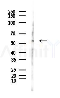 Chk1 Antibody - Western blot analysis of lysates from Hela cells(LPS, 4h treatment), using Chk1 Antibody at 1/1000 dilution.