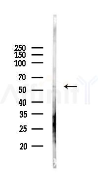 Chk1 Antibody - Western blot analysis of lysates from Mouse lung, using Chk1 Antibody at 1/1000 dilution.
