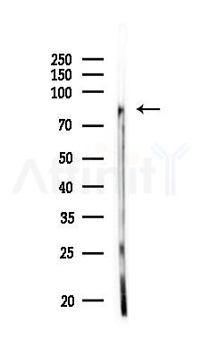 IKK alpha Antibody - Western blot analysis of lysates from MDA-MB-231 cells, using IKK alpha Antibody at 1/1000 dilution.