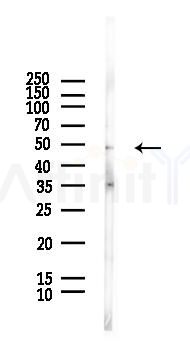 HDAC3 Antibody - Western blot analysis of lysates from HUVEC cells(LPS, 4h treatment), using HDAC3 Antibody at 1/1000 dilution.