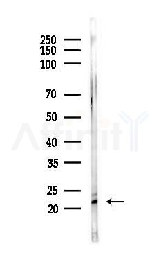 Survivin Antibody - Western blot analysis of lysates from HepG2 cells(starvation,24h treatment), using Survivin Antibody at 1/1000 dilution.