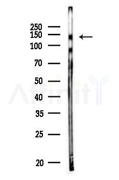 JAK2 Antibody - Western blot analysis of lysates from PC12 cells, using JAK2 Antibody at 1/1000 dilution.