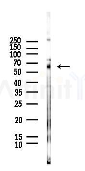 Chk2 Antibody - Western blot analysis of lysates from Hela cells(LPS, 4h treatment), using Chk2 Antibody at 1/1000 dilution.