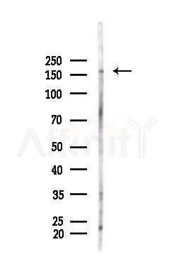 EGFR Antibody - Western blot analysis of lysates from Hela cells(heat-shock,45min treatment), using EGFR Antibody at 1/1000 dilution.