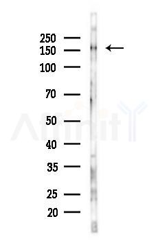 EGFR Antibody - Western blot analysis of lysates from Mouse liver, using EGFR Antibody at 1/1000 dilution.