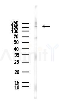 EGFR Antibody - Western blot analysis of lysates from HUVEC cells(LPS, 4h treatment), using EGFR Antibody at 1/1000 dilution.