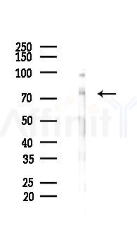C-RAF Antibody - Western blot analysis of lysates from Hela cells(LPS, 4h treatment), using C-RAF Antibody at 1/1000 dilution.