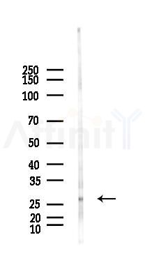 HSP27 Antibody - Western blot analysis of lysates from Hela cells(LPS, 4h treatment), using HSP27 Antibody at 1/1000 dilution.