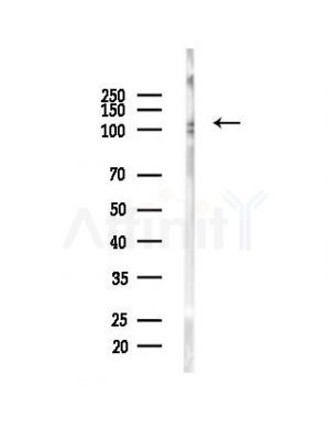 ATP1A1 Antibody - Western blot analysis of lysates from MDA-MB-231 cells(heat-shock,45min treatment), using ATP1A1 Antibody at 1/1000 dilution.