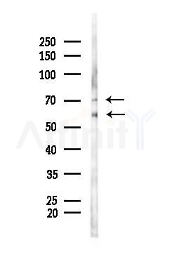 ICAM1 Antibody - Western blot analysis of lysates from Hela cells(heat-shock,45min treatment), using ICAM1 Antibody at 1/1000 dilution.