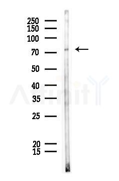 PKC beta 1 Antibody - Western blot analysis of lysates from HUVEC cells, using PKC beta 1 Antibody at 1/1000 dilution.