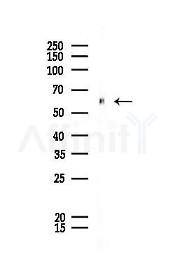 Fyn Antibody - Western blot analysis of lysates from HUVEC cells, using Fyn Antibody at 1/1000 dilution.