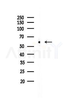 Fyn Antibody - Western blot analysis of lysates from PC12 cells, using Fyn Antibody at 1/1000 dilution.
