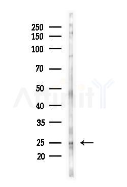 eIF4E Antibody - Western blot analysis of lysates from Mouse liver, using eIF4E Antibody at 1/1000 dilution.