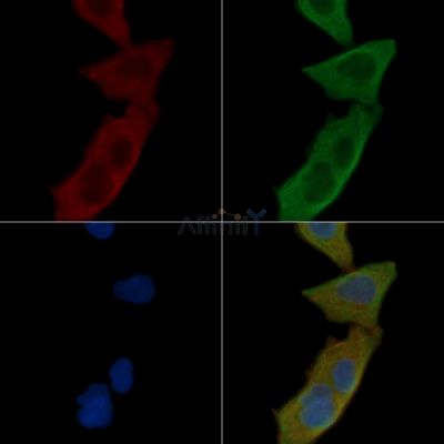 MCSF Receptor Antibody - AF6116 staining Hela cells(30min of UV treatment) by IF/ICC.