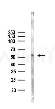 Lyn Antibody - Western blot analysis of lysates from Mouse lung, using Lyn Antibody at 1/1000 dilution.
