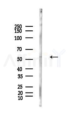 Lyn Antibody - Western blot analysis of lysates from Hela cells(LPS, 4h treatment), using Lyn Antibody at 1/1000 dilution.
