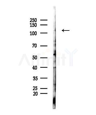 AR Antibody - Western blot analysis of lysates from Mouse lung, using AR Antibody at 1/1000 dilution.