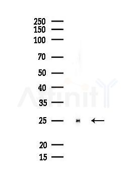 Bcl-2 Antibody - Western blot analysis of lysates from Rat muscle, using Bcl-2 Antibody at 1/1000 dilution.