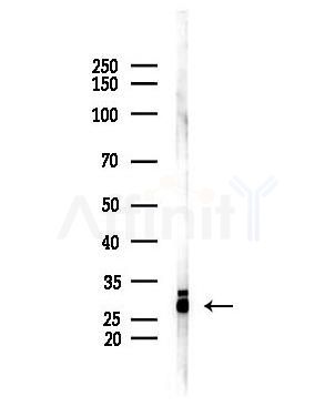 Bcl-2 Antibody - Western blot analysis of lysates from Mouse lung, using Bcl-2 Antibody at 1/1000 dilution.