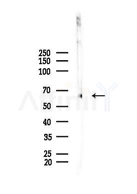 SRF Antibody - Western blot analysis of lysates from A375 cells(heat-shock,45min treatment), using SRF Antibody at 1/1000 dilution.