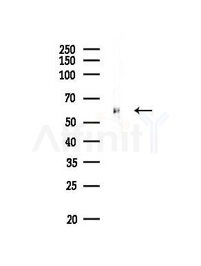 Src Antibody - Western blot analysis of lysates from A549 cells, using Src Antibody at 1/1000 dilution.