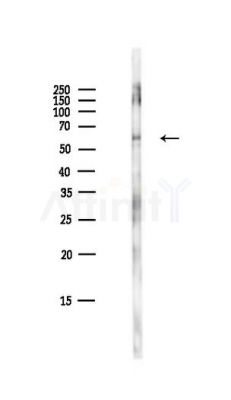 Cyclin B1 Antibody - Western blot analysis of lysates from HepG2 cells(LPS,4h treatment), using Cyclin B1 Antibody at 1/1000 dilution.