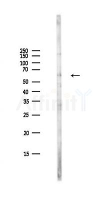 Cyclin B1 Antibody - Western blot analysis of lysates from PC12 cells(LPS,4h treatment), using Cyclin B1 Antibody at 1/1000 dilution.