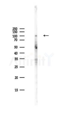 B Raf Antibody - Western blot analysis of lysates from PC12 cells(LPS,4h treatment), using B Raf Antibody at 1/1000 dilution.