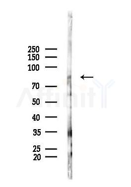 B Raf Antibody - Western blot analysis of lysates from A375 cells(heat-shock,45min treatment), using B Raf Antibody at 1/1000 dilution.