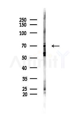 Ezrin Antibody - Western blot analysis of lysates from Mouse lung, using Ezrin Antibody at 1/1000 dilution.