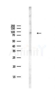 CD31 Antibody - Western blot analysis of lysates from PC12 cells(LPS,4h treatment), using CD31 Antibody at 1/1000 dilution.