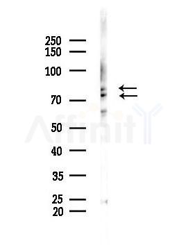 Synapsin I Antibody - Western blot analysis of lysates from Mouse lung, using Synapsin I Antibody at 1/1000 dilution.